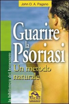 guarire la psoriasi