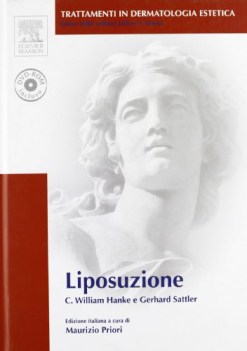 liposuzione