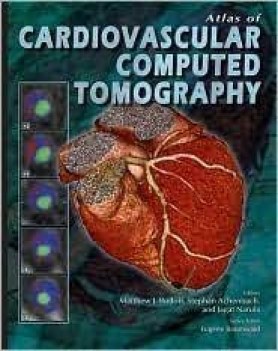 atlas of cardiovascular computed tomography