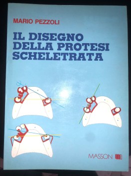 disegno della protesi scheletrata