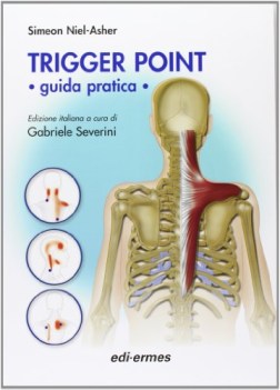 trigger point