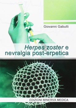 herpes zoster e nevralgia posterpetica