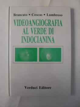 videoangiografia al verde di indocianina