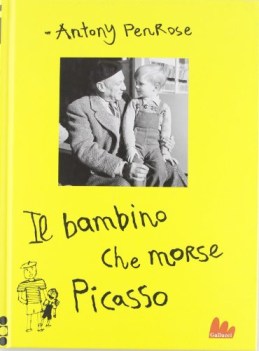 bambino che morse picasso